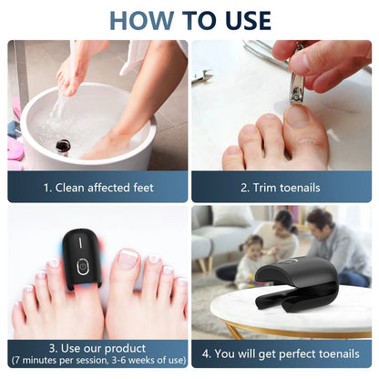 Fast Nail Fungus Repair with Fungal Nail Laser Device - Effective Onychomycosis Treatment