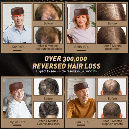 Laser Hair Growth Cap – 96 LED Red Light Therapy 660nm & 850nm for Hair Loss & Scalp Care