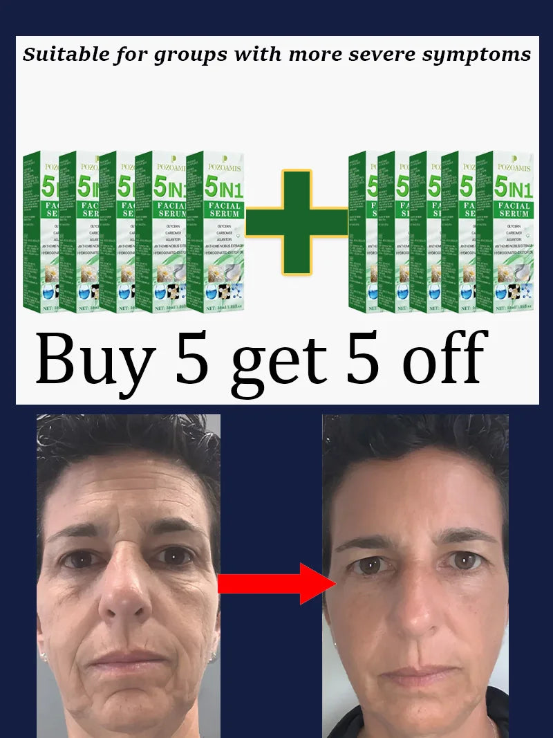 Anti-Aging Skincare Guide – Secrets to Quickly Reduce Wrinkles & Achieve a Youthful Appearance Naturally