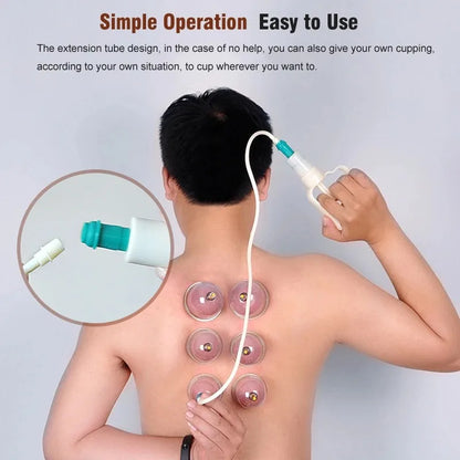 32PCS Professional Vacuum Cupping Set — Body Massager with Suction Cups for Relaxation, Detox & Anti-Cellulite Therapy