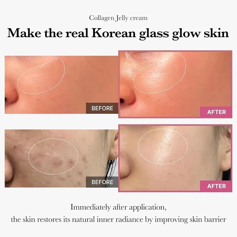 100g Collagen Jelly Face Cream – Nourishing Moisturizer, Pore Shrinking & Comedone Removal, Korean Skin Care