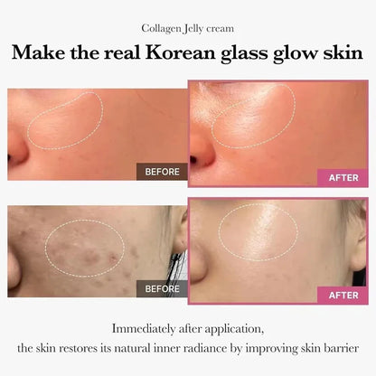 100g Collagen Jelly Face Cream – Nourishing Moisturizer, Pore Shrinking & Comedone Removal, Korean Skin Care
