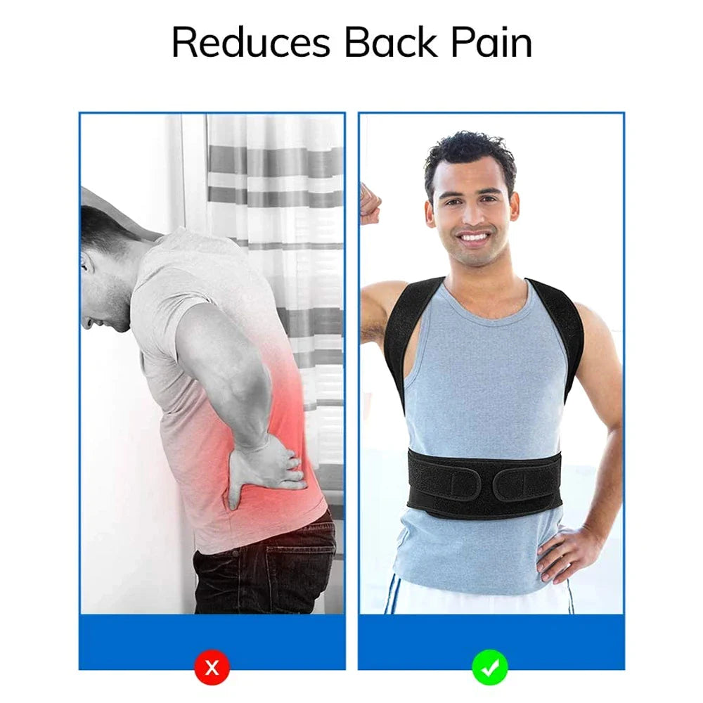 Back Brace Posture Corrector — Adjustable Back Straightener for Women & Men | Scoliosis & Hunchback Correction Posture Trainer