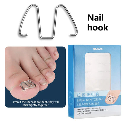Ingrown Toenail Correction Tool Kit – Stainless Steel Nail Straightening Hook & Clip for Paronychia Treatment Pedicure Care