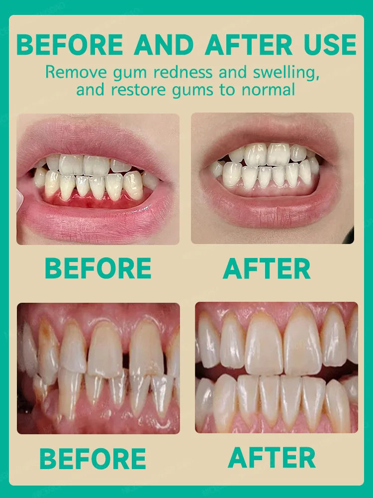 Effective Gum Repair – Relieve Toothache, Strengthen Teeth & Gum Health