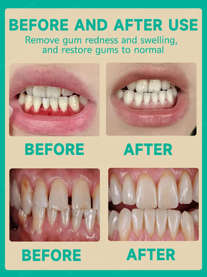 Effective Gum Repair – Relieve Toothache, Strengthen Teeth & Gum Health