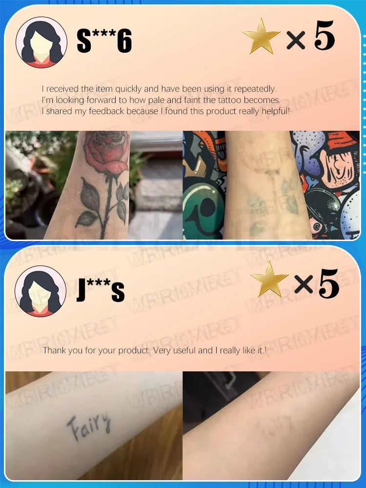Laser Tattoo Removal Pen – Effective Portable Tattoo Eraser