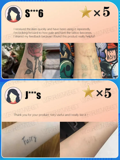 Laser Tattoo Removal Pen – Effective Portable Tattoo Eraser