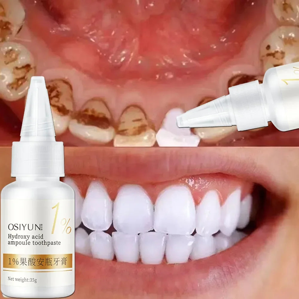 Teeth Whitening Toothpaste – Fruit Acid Formula for Plaque Removal, Stain & Calculus Cleanser, Fresh Breath & Oral Hygiene