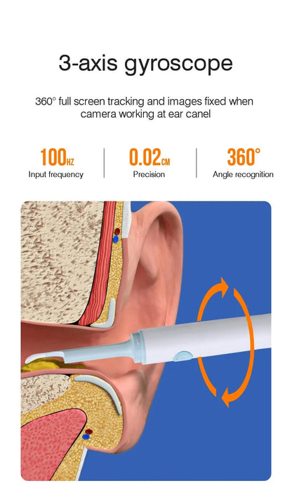 Wireless Visual Ear Endoscope Camera – 5MP Ear Cleaning Tools with Safe Silicone Earpick, Luminous Otoscope & Ear Wax Remover