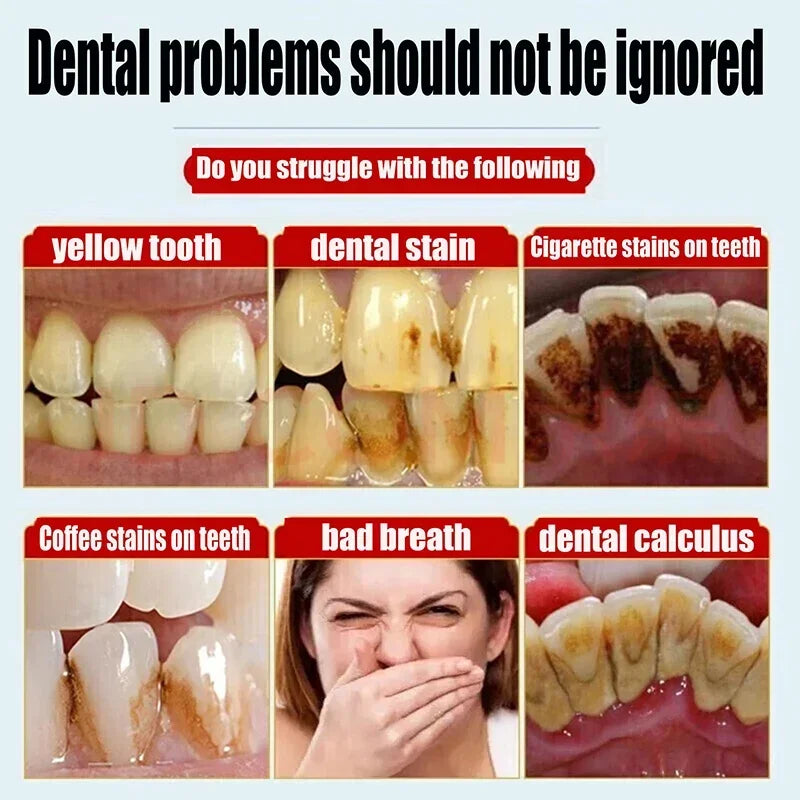Dental Calculus Remover & Whitening Toothpaste – Fresh Breath & Periodontitis Prevention