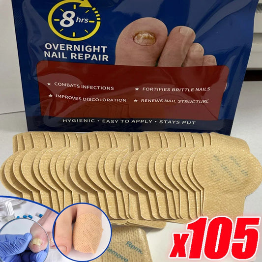 21/105pcs Waterproof Nail Fungus Repair Patches — Ingrown Nail Correction Stickers for Damaged Nail & Feet Care