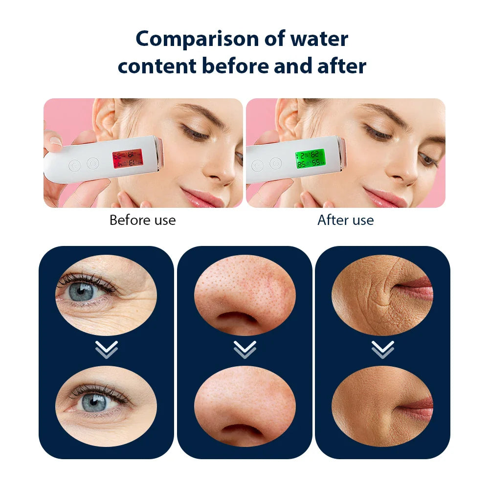 Oxygen Bubble Pen - Portable CO2 Oxygen Facial Machine for Skin Care, Facial SPA & Beauty Treatment
