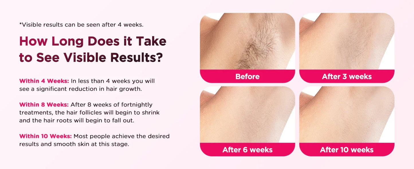 990,000 Flash IPL Laser Epilator — Permanent Painless Hair Removal for Men & Women, Body & Bikini