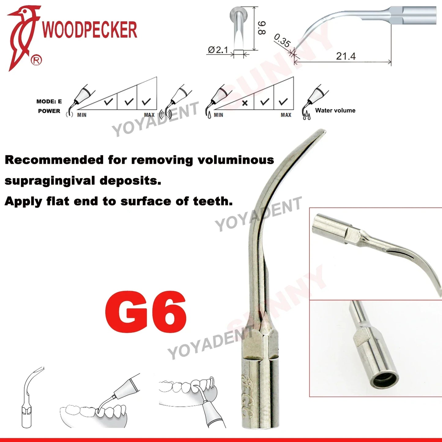 Woodpecker Dental Scaler Tips – Ultrasonic Tooth Cleaning, Endo & Perio Scaling Tips, Fit EMS UDS Scaler Handpiece