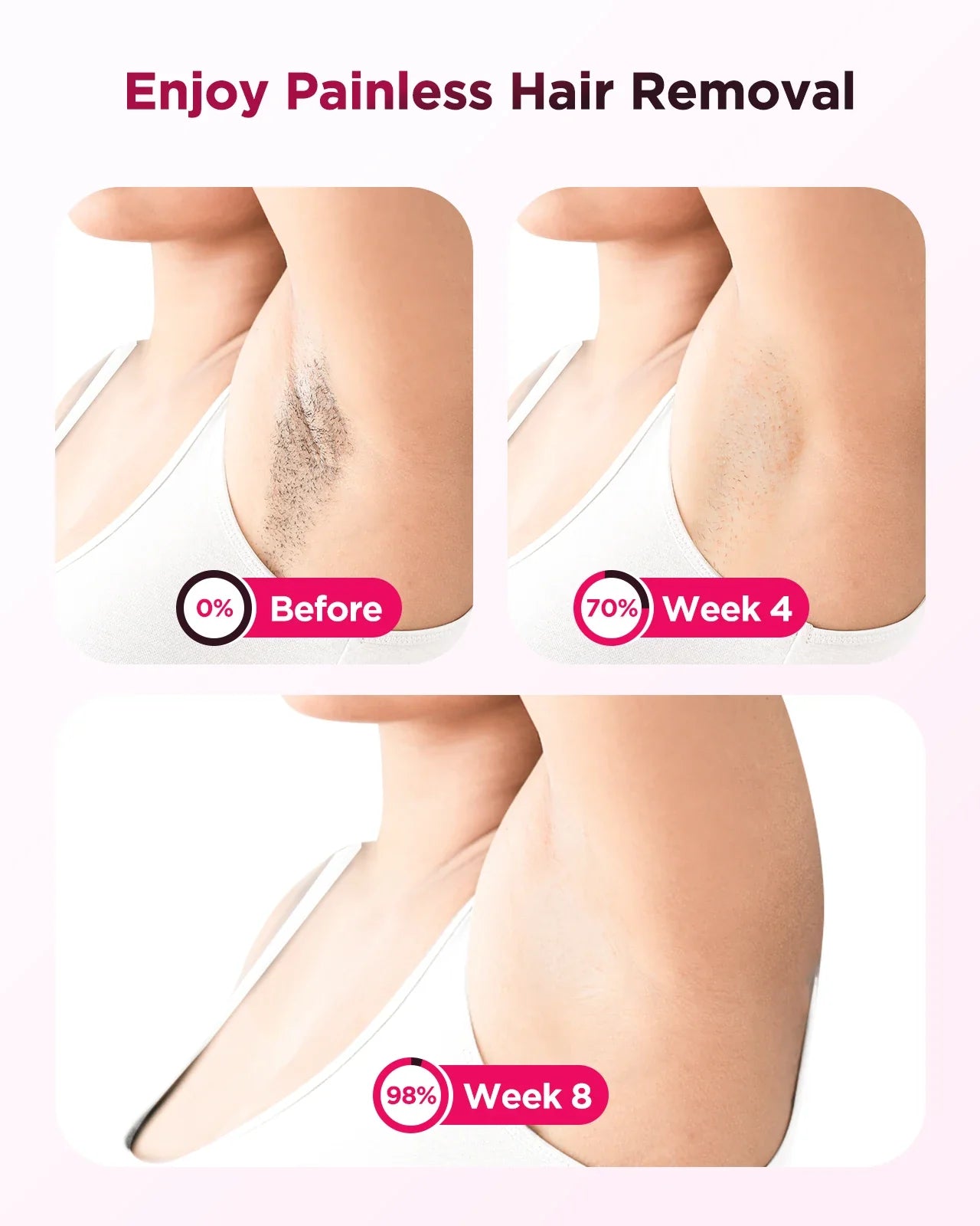 990,000 Flash IPL Laser Epilator — Permanent Painless Hair Removal for Men & Women, Body & Bikini