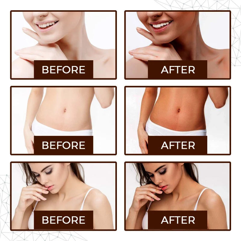 Self Spray Tan Mousse with Natural Tanning Oil — Gradual Face & Body Bronzer, Quick-Dry Moisturizer 30ml