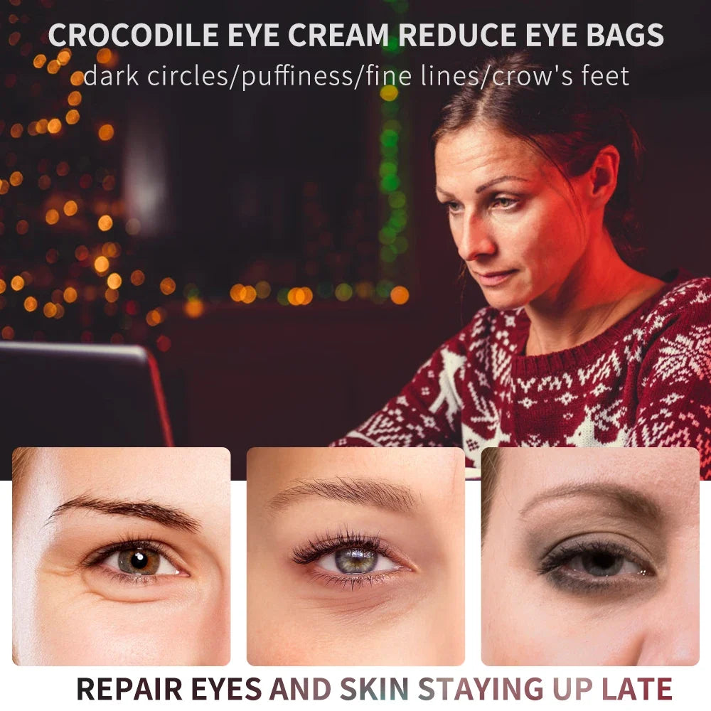 Peptide Collagen Eye Essence Cream - Anti-Wrinkle Dark Circle & Puffy Eye Repair Care (20g)