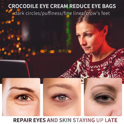 Peptide Collagen Eye Essence Cream - Anti-Wrinkle Dark Circle & Puffy Eye Repair Care (20g)