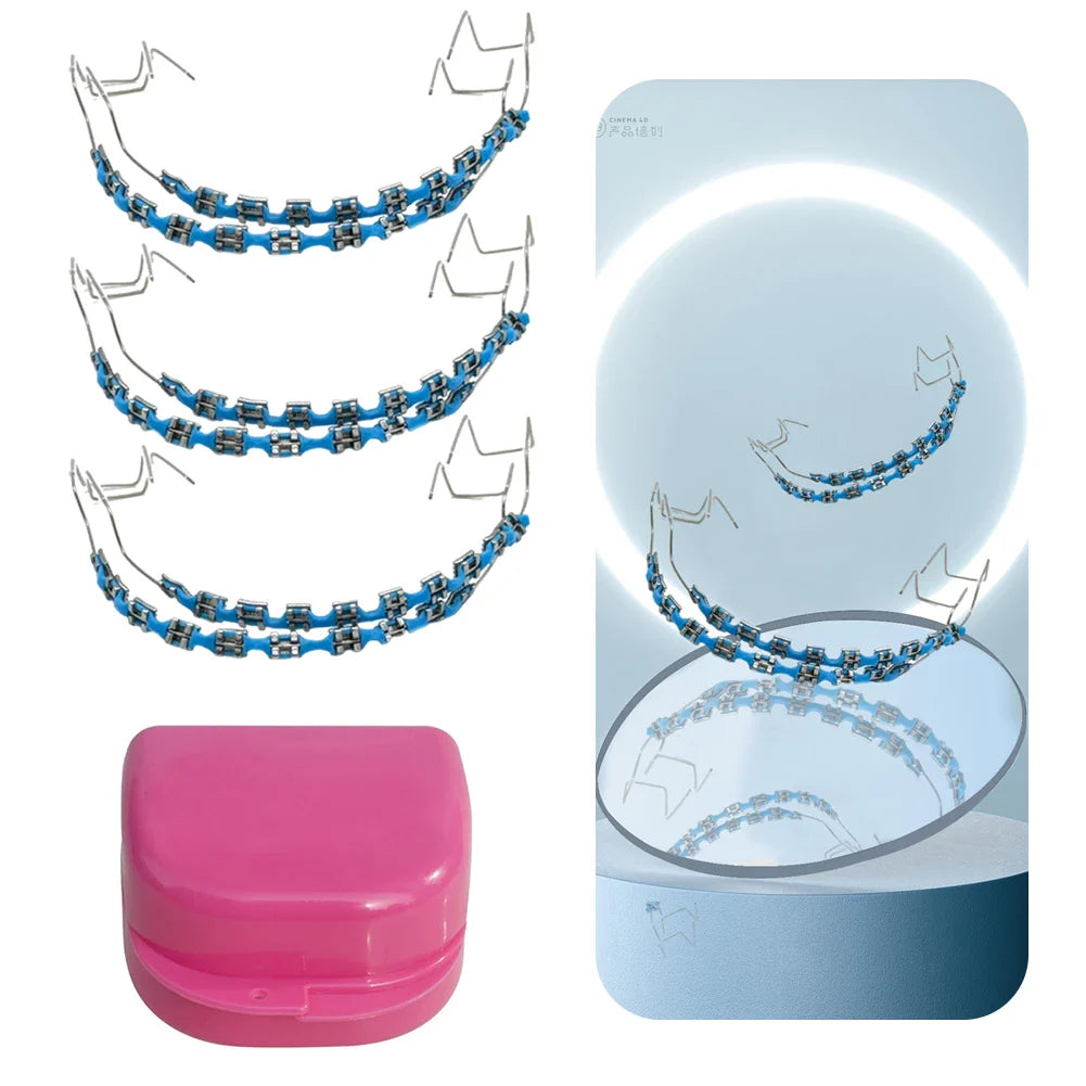 Fashion Temporary Tooth Braces – High-Quality Dental Fake Braces with Metal Wires and Brackets