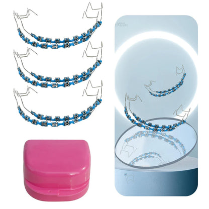 Fashion Temporary Tooth Braces – High-Quality Dental Fake Braces with Metal Wires and Brackets
