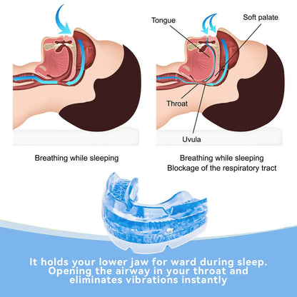 Adjustable Anti-Snoring Mouth Guard – Sleep Aid Mouthpiece for Bruxism, Anti-Apnea & Snoring Relief