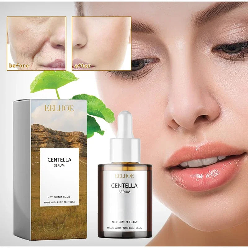 Centella Asiatica Face Serum – Nourishing, Brightening & Moisturizing Cream for Dry Skin Rejuvenation