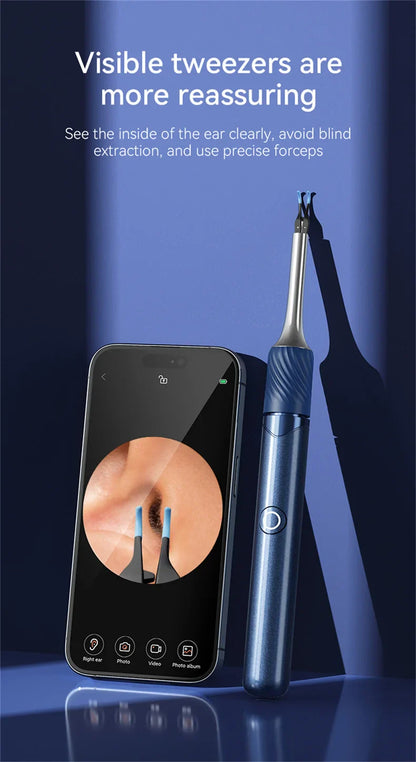 Visual Ear Cleaner with Camera – Ear Wax Removal Tool with 12MP, Ear Pick, Tweezers & 6 Ear Spoons for Ear Care