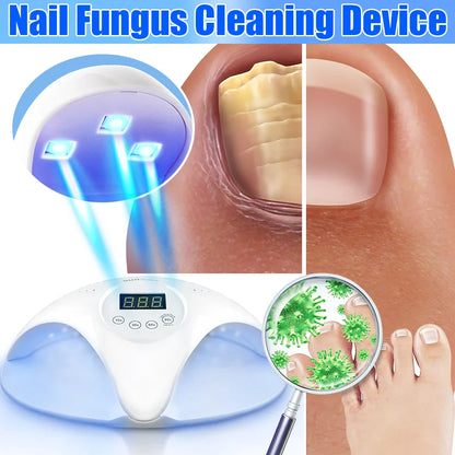 Fungal Nail Laser Device – Fast Toenail & Fingernail Fungus Repair, Onychomycosis Treatment for Hand & Foot Care