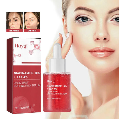 Niacinamide Serum – Dark Spot Correcting, Moisturizing & Brightening, Fades Fine Lines, Deep Cleansing Korean Skincare