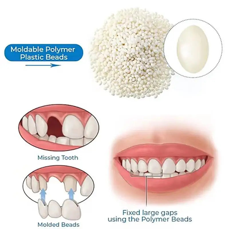 Moldable False Teeth Repair Kit – Tooth Granules & Beads for Temporary Filling, Broken Tooth Fix, Thermal Fit Q6N2