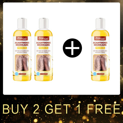 EELHOE Peeling Oil for Dark Skin — 110ml Exfoliator to Remove Dead Skin & Brighten Arms, Elbows, Knees, Legs