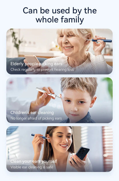Visual Ear Cleaner with Camera – Ear Wax Removal Tool with 12MP, Ear Pick, Tweezers & 6 Ear Spoons for Ear Care