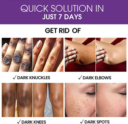 AILKE Glutathione Lightening Body Lotion – Moisturizing & Hydrating for Even Skin Tone and Dark Spot Improvement