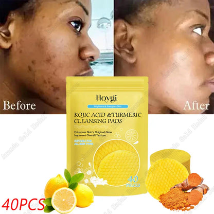 Turmeric & Kojic Acid Facial Cleansing Pads — Lemon Deep Cleanse, Brightening & Whitening Cotton Pads for Face Skincare
