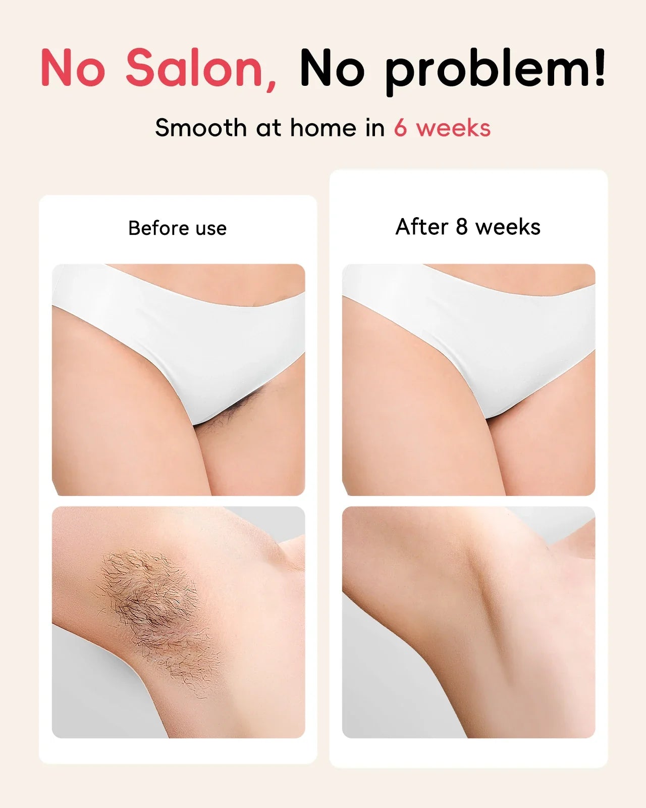 IPL Hair Removal Laser 22J — Unlimited Flashes IGBT, 5.2cm² Light Painless Epilator for Face, Armpit & Bikini Body Treatment