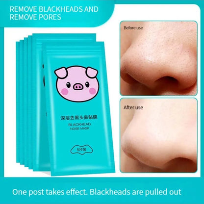 5PCS Blackhead Removal Nasal Strips – Acne & Pore Shrinking, Deep Cleaning Magic Adsorption for Smooth Skin