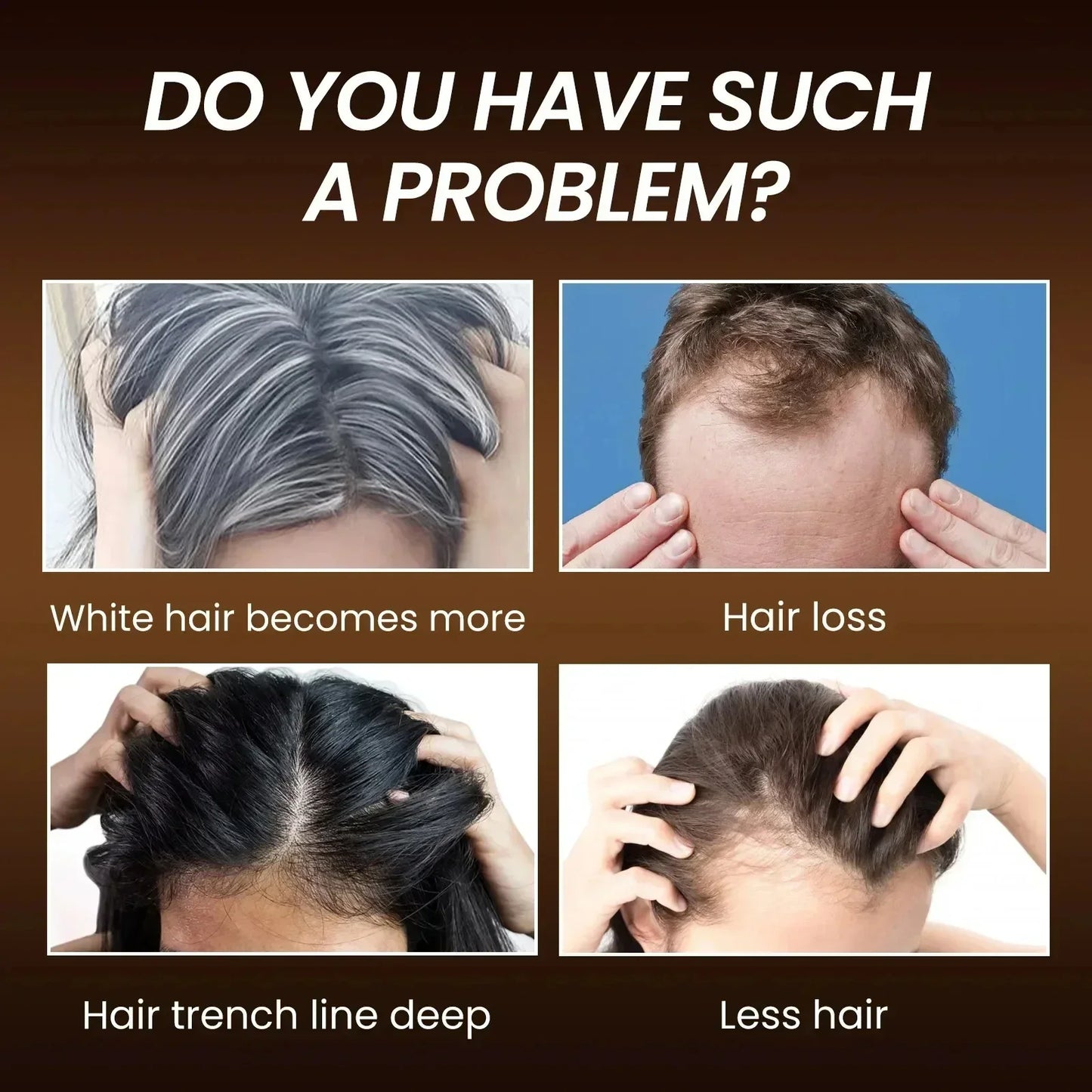 White Hair Remover – Restore Natural Hair Color in 7 Days, Gray Hair Treatment Solution