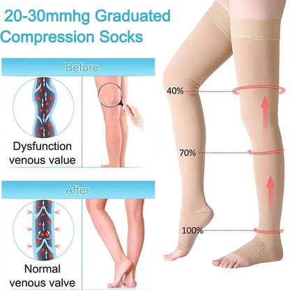 Thigh High 20-32 mmHg Toeless Compression Socks – Circulation Support for Men & Women with Silicone Dot Band