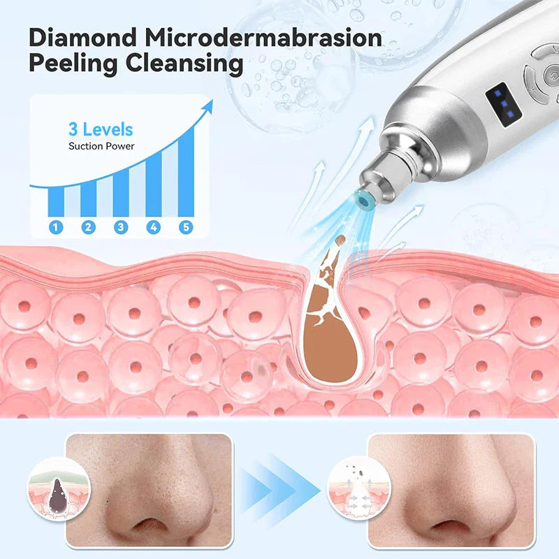 Upgraded Diamond Microdermabrasion Machine - Blackhead Removal & Professional Facial Deep Cleansing Device for Home Skin Care