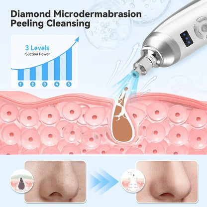 Upgraded Diamond Microdermabrasion Machine - Blackhead Removal & Professional Facial Deep Cleansing Device for Home Skin Care