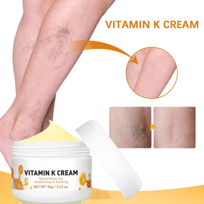 Vitamin K Leg Care Cream - Soothing Massage Cream for Tired Legs, Varicose Vein & Spider Vein Appearance Support