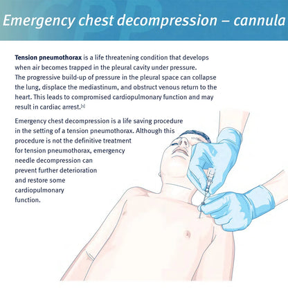 Sanke Rescue Pneumothorax Needle - Trauma Medical Chest Catheter for Decompression - Essential EDC First Aid Kit Component