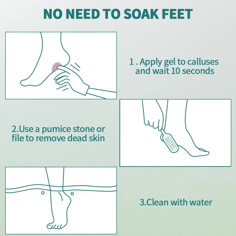 NAILPOP Extra Strength Callus Remover & Foot File Kit - Fast Hard Skin, Heel & Tough Callus Removal