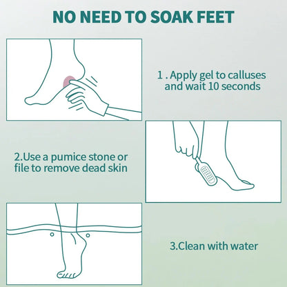 NAILPOP Extra Strength Callus Remover & Foot File Kit - Fast Hard Skin, Heel & Tough Callus Removal