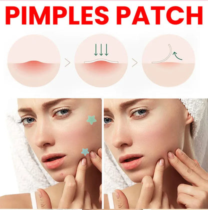 Acne Repair Patch - Facial Skin Care for Blemish & Pimple Marks, Acne Treatment & Pimple Repair Cover