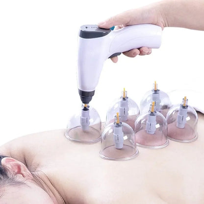 Electric Cupping Machine – Household Vacuum Cupping Set with Easy Suction Gas Tank