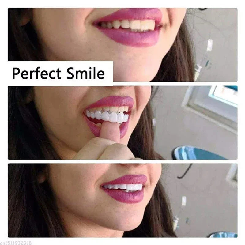 Silicone Denture Set — Temporary Orthodontic Teeth, Fake Tooth Braces for Oral Hygiene, Whitening & Dental Simulation