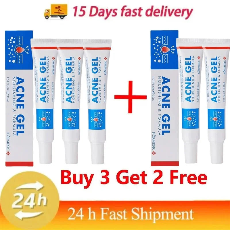Effective Acne Removal Cream 30g – Anti-Acne Gel for Redness, Pimples, Deep Pore Cleaning & Oil Control Skin Care