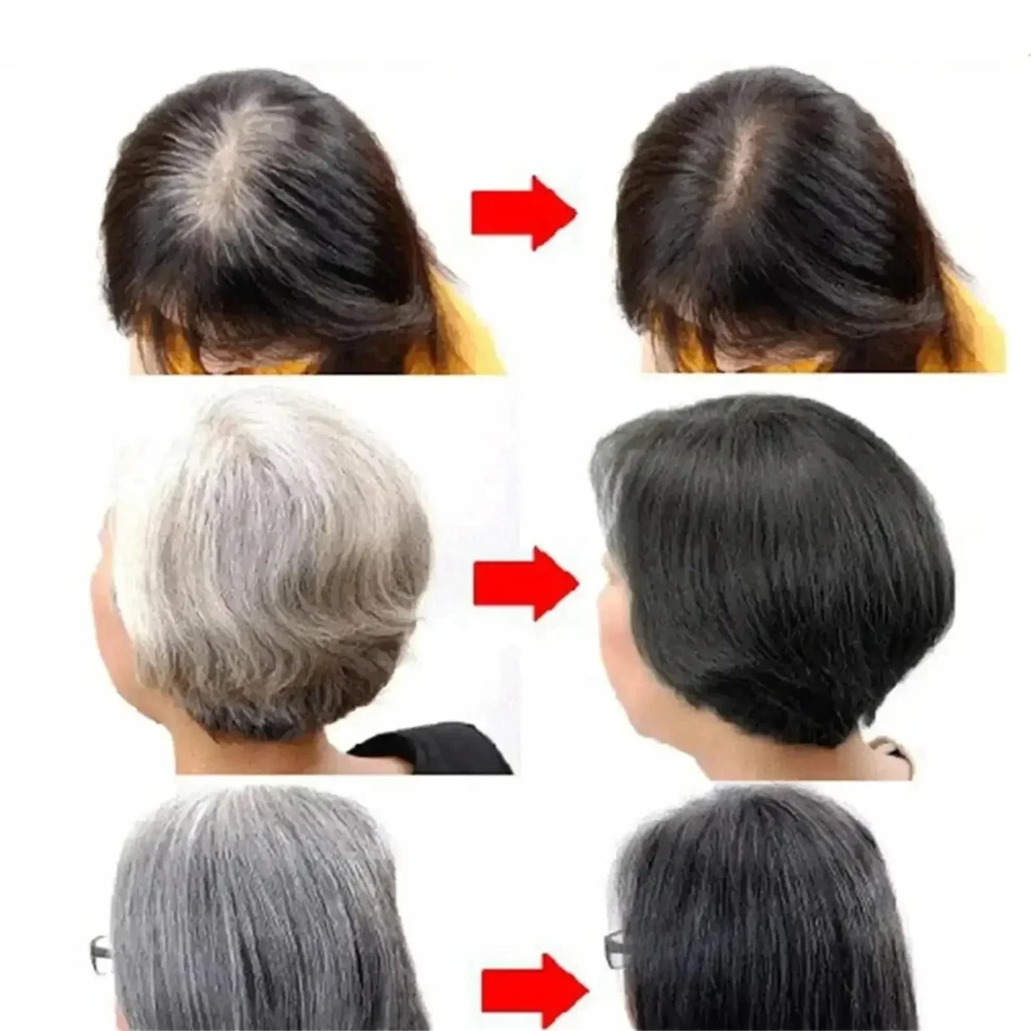 White Hair Remover – Restore Natural Hair Color in 7 Days, Gray Hair Treatment Solution